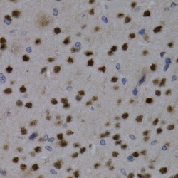 Myocyte Enhancer Factor 2C (MEF2C) Antibody
