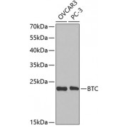 Western blot analysis of extracts of various cell lines, using BTC antibody (abx002023) at 1/1000 dilution.