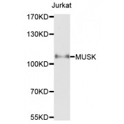 Western blot analysis of extracts of Jurkat cells, using MUSK antibody (abx002025) at 1/1000 dilution.