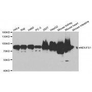 Western blot analysis of extracts of various cell lines, using NDUFS1 antibody (abx002026) at 1/1000 dilution.