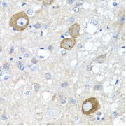 Immunohistochemistry of paraffin-embedded rat brain using NRG4 antibody (abx002032) at dilution of 1/100 (40x lens).