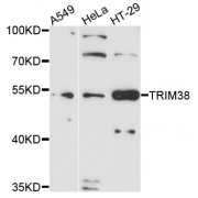 Western blot analysis of extracts of various cell lines, using TRIM38 antibody (abx002033) at 1/1000 dilution.