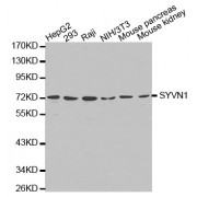 Western blot analysis of extracts of various cell lines, using SYVN1 antibody (abx002034).