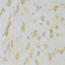 Caspase 9 (CASP9) Antibody