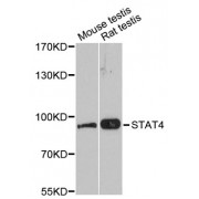 Western blot analysis of extracts of various cell lines, using STAT4 antibody (abx002047) at 1:3000 dilution.