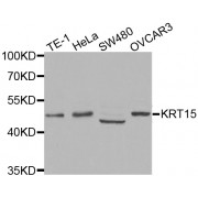 Western blot analysis of extracts of various cell lines, using KRT15 antibody (abx002050) at 1:400 dilution.