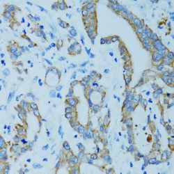 Keratin 15 (KRT15) Antibody