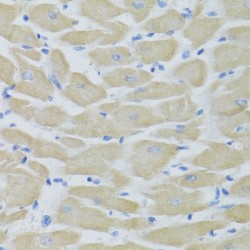 Keratin, Type II Cytoskeletal 5 (KRT5) Antibody