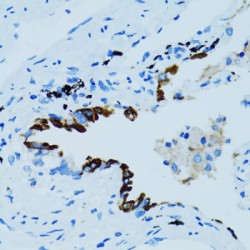 Cathepsin E (CTSE) Antibody