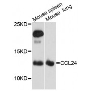 Western blot analysis of extracts of various cell lines, using CCL24 antibody (abx002059) at 1:3000 dilution.