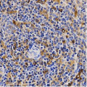 Immunohistochemistry of paraffin-embedded rat spleen using CDK20 antibody (abx002060) at dilution of 1/200 (40x lens).