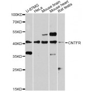 Western blot analysis of extracts of various cell lines, using CNTFR antibody (abx002062) at 1:3000 dilution.