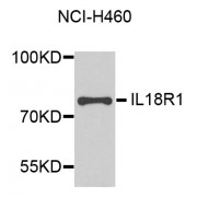 Western blot analysis of extracts of NCI-H460 cells, using IL18R1 antibody (abx002063) at 1/1000 dilution.