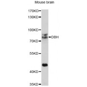 Western blot analysis of extracts of mouse brain, using DBH antibody (abx002064) at 1/1000 dilution.