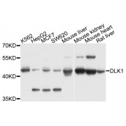 Western blot analysis of extracts of various cell lines, using DLK1 antibody (abx002066) at 1/1000 dilution.