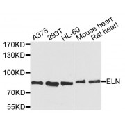 Western blot analysis of extracts of various cell lines, using ELN antibody (abx002068) at 1/1000 dilution.