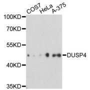 Western blot analysis of extracts of various cell lines, using DUSP4 antibody (abx002069) at 1:3000 dilution.