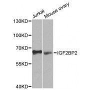 Western blot analysis of extracts of various cell lines, using IGF2BP2 antibody (abx002079) at 1/1000 dilution.