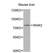 Western blot analysis of extracts of mouse liver, using IRAK2 antibody (abx002082) at 1/1000 dilution.