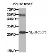 Western blot analysis of extracts of mouse testis, using NEUROG3 antibody (abx002086) at 1:400 dilution.