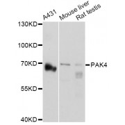 Western blot analysis of extracts of various cell lines, using PAK4 Antibody (abx002088) at 1:3000 dilution.
