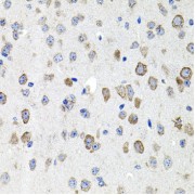 Immunohistochemistry of paraffin-embedded mouse brain using CDH23 antibody (abx002090) at dilution of 1/100 (40x lens).