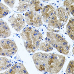 Cadherin Related 23 (CDH23) Antibody