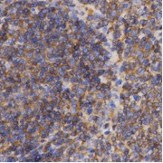 Immunohistochemistry of paraffin-embedded rat spleen using PDCD10 antibody (abx002091) at dilution of 1/200 (40x lens).