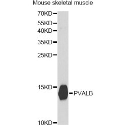 Parvalbumin Alpha (PVALB) Antibody