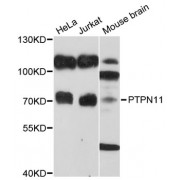 Western blot analysis of extracts of various cell lines, using PTPN11 antibody (abx002096) at 1/1000 dilution.