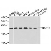 Western blot analysis of extracts of various cell lines, using RAB18 antibody (abx002101) at 1/1000 dilution.