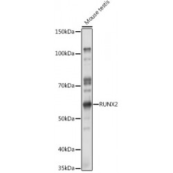 Runt-Related Transcription Factor 2 (RUNX2) Antibody