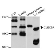 Western blot analysis of extracts of various cell lines, using CLEC5A antibody (abx002111) at 1/1000 dilution.