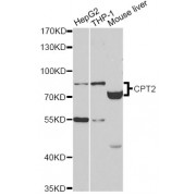 Western blot analysis of extracts of various cell lines, using CPT2 antibody (abx002112) at 1:400 dilution.