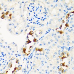 Carnitine Palmitoyltransferase 2, Mitochondrial (CPT2) Antibody