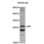 Western blot analysis of extracts of mouse eye, using MIP antibody (abx002119) at 1:400 dilution.