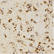 Immunohistochemistry of paraffin-embedded rat brain using LAMP3 antibody (abx002126) at dilution of 1/200 (40x lens).