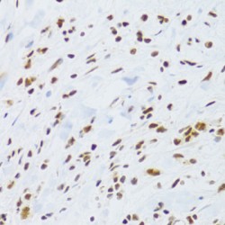 DNA Damage-Binding Protein 1 (DDB1) Antibody