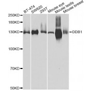 Western blot analysis of extracts of various cell lines, using DDB1 Antibody (abx002127) at 1/500 dilution.