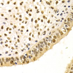 DNA Damage-Binding Protein 1 (DDB1) Antibody