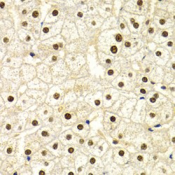 DNA Damage-Binding Protein 1 (DDB1) Antibody