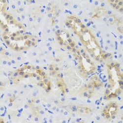 Disrupted In Schizophrenia 1 Protein (DISC1) Antibody