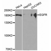 Western blot analysis of extracts of various cell lines, using EGFR antibody (abx002135) at 1/500 dilution.
