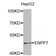 Western blot analysis of extracts of HepG2 cells, using ENPP7 antibody (abx002136) at 1:400 dilution.