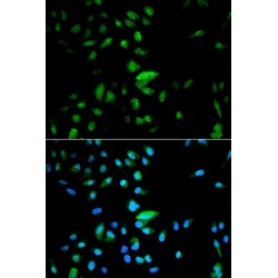 Forkhead Box Protein O1 (FOXO1) Antibody