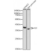 Western blot analysis of extracts of various cell lines, using FST antibody (1/500 dilution).