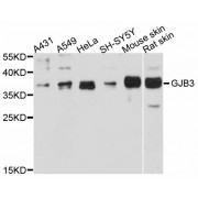 Western blot analysis of extracts of various cell lines, using GJB3 antibody (abx002149) at 1:3000 dilution.