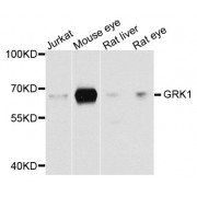 Western blot analysis of extracts of various cell lines, using GRK1 antibody (abx002158) at 1/1000 dilution.