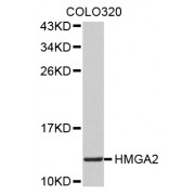 Western blot analysis of extracts of COLO320 cells, using HMGA2 antibody (abx002163).