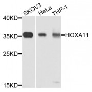 Western blot analysis of extracts of various cell lines, using HOXA11 antibody (abx002166) at 1/1000 dilution.